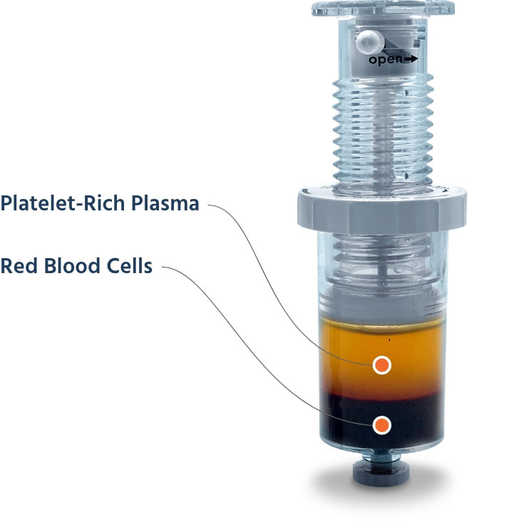 One of the dual chambers of Healeon Duet