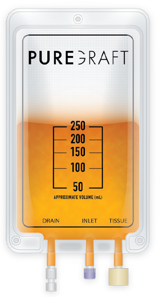 Illustration of PureGraft® bag with fat inside