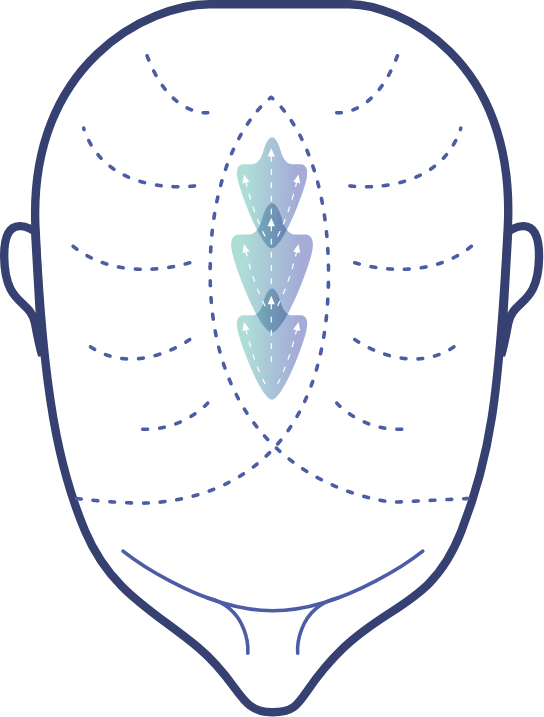 Kerastem diagram on top of the head